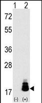 4EBP1 Antibody in Western Blot (WB)