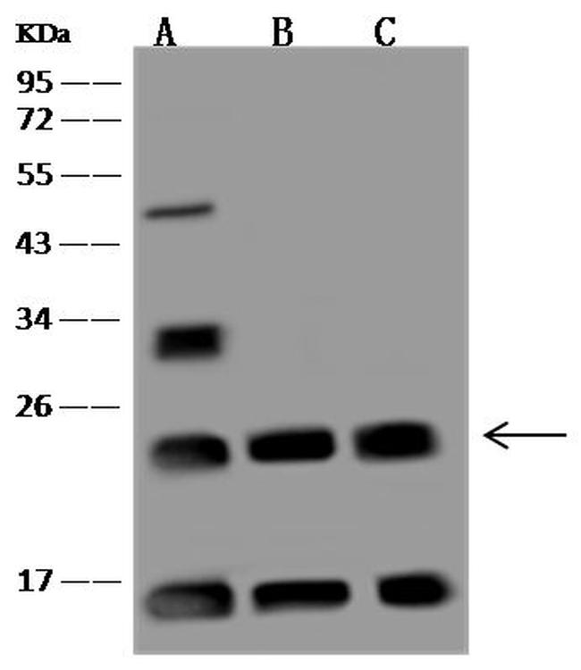 UBE2T Antibody in Western Blot (WB)