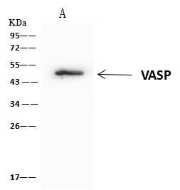 VASP Antibody in Immunoprecipitation (IP)