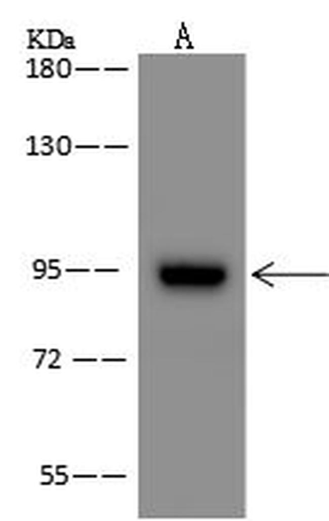 ZNF711 Antibody in Western Blot (WB)