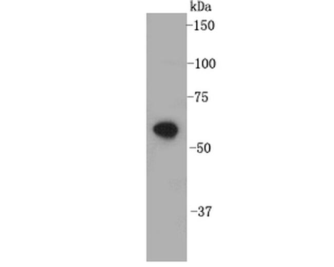 CHFR Antibody in Western Blot (WB)