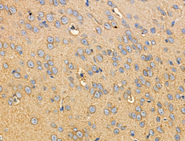 Phospho-RIP2 (Ser176) Antibody in Immunohistochemistry (Paraffin) (IHC (P))