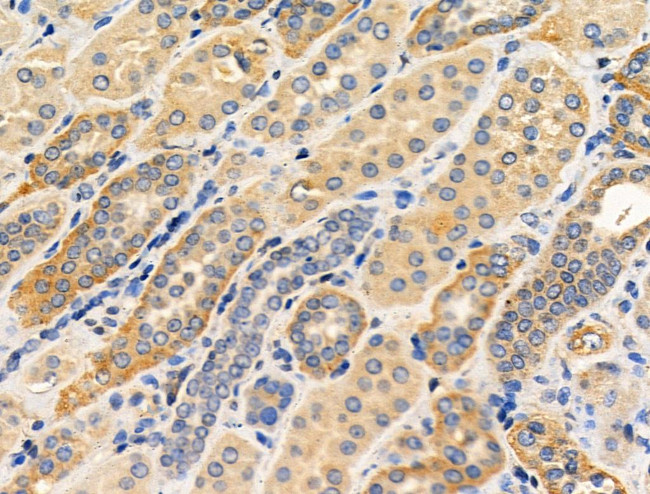 Phospho-RIP2 (Ser176) Antibody in Immunohistochemistry (Paraffin) (IHC (P))