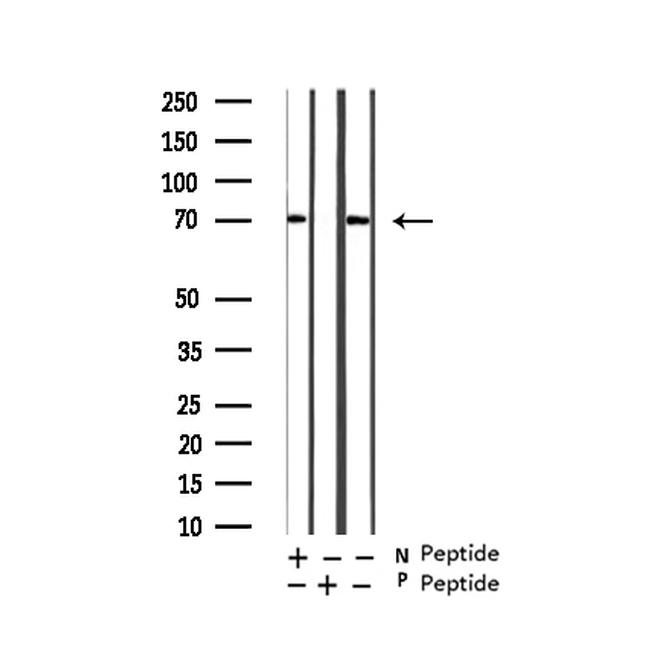 Phospho-RIP2 (Ser176) Antibody in Western Blot (WB)