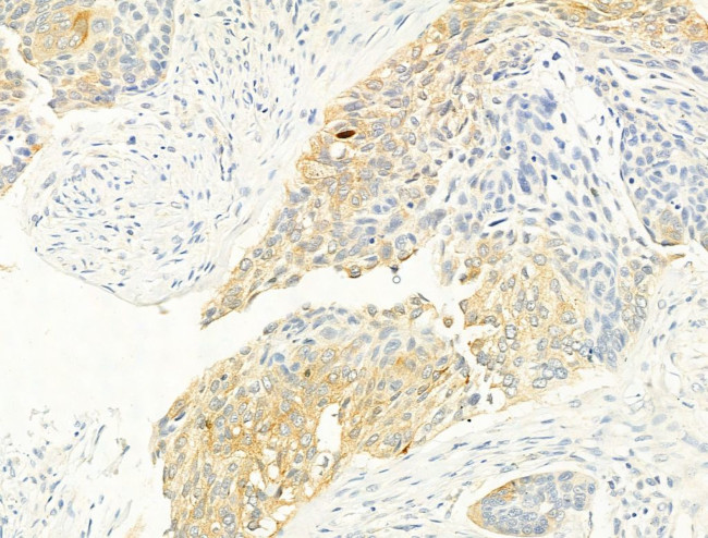 Phospho-ROCK2 (Tyr722) Antibody in Immunohistochemistry (Paraffin) (IHC (P))