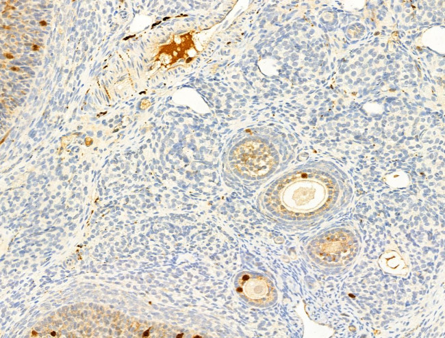 Phospho-ROCK2 (Tyr722) Antibody in Immunohistochemistry (Paraffin) (IHC (P))