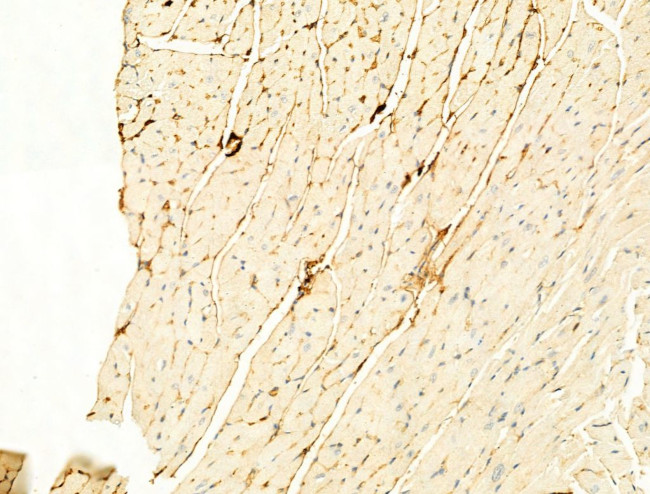 Phospho-ROCK2 (Tyr722) Antibody in Immunohistochemistry (Paraffin) (IHC (P))