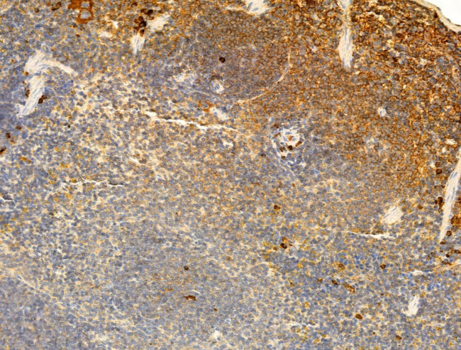 Phospho-ROCK2 (Tyr722) Antibody in Immunohistochemistry (Paraffin) (IHC (P))