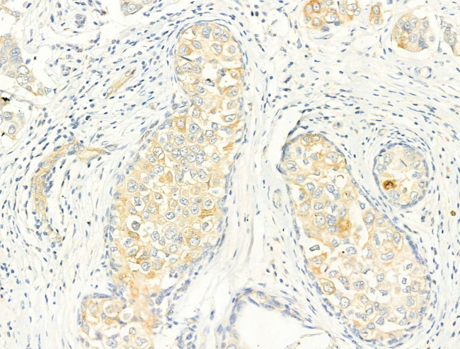 Phospho-ROCK2 (Tyr722) Antibody in Immunohistochemistry (Paraffin) (IHC (P))