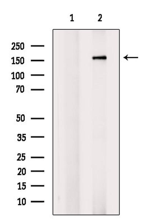 Phospho-ROCK2 (Tyr722) Antibody in Western Blot (WB)