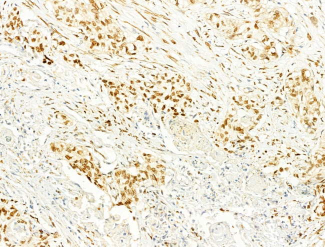 Phospho-JNK1/JNK2/JNK3 (Thr183, Tyr185) Antibody in Immunohistochemistry (Paraffin) (IHC (P))