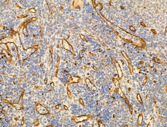 Phospho-JNK1/JNK2/JNK3 (Thr183, Tyr185) Antibody in Immunohistochemistry (Paraffin) (IHC (P))