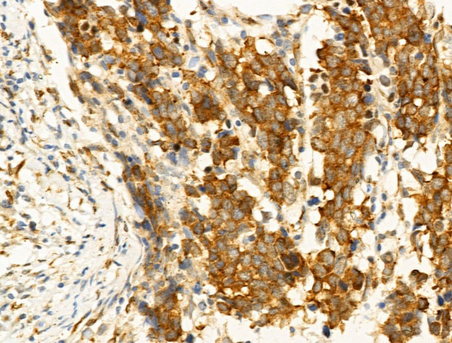 Phospho-JNK1/JNK2/JNK3 (Thr183, Tyr185) Antibody in Immunohistochemistry (Paraffin) (IHC (P))