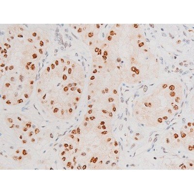 Phospho-JNK1/JNK2/JNK3 (Thr183, Tyr185) Antibody in Immunohistochemistry (Paraffin) (IHC (P))