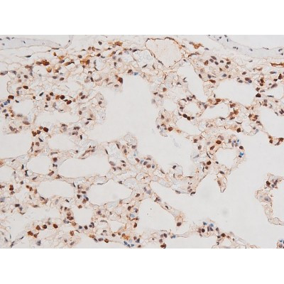 Phospho-JNK1/JNK2/JNK3 (Thr183, Tyr185) Antibody in Immunohistochemistry (Paraffin) (IHC (P))