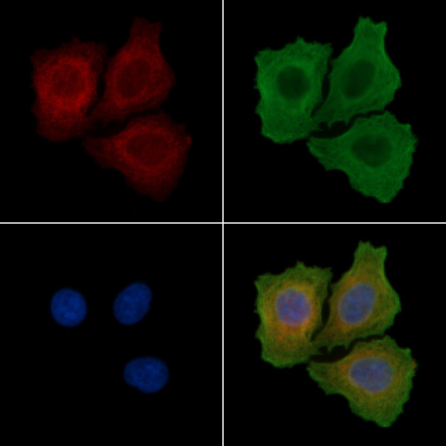 Phospho-FRS2 (Tyr436) Antibody in Immunocytochemistry (ICC/IF)