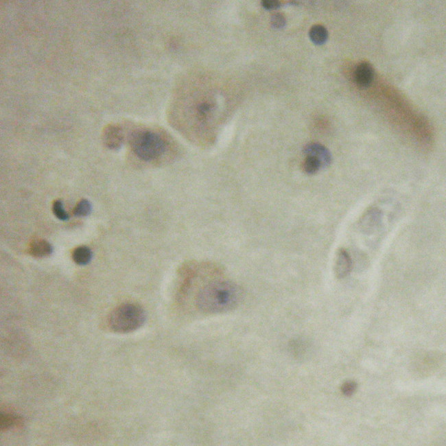 Phospho-FRS2 (Tyr436) Antibody in Immunohistochemistry (Paraffin) (IHC (P))