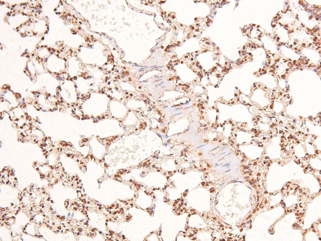 Phospho-BRCA1 (Ser1497) Antibody in Immunohistochemistry (Paraffin) (IHC (P))