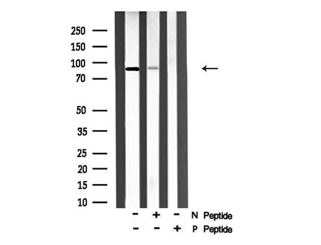 Phospho-Leptin Receptor (Tyr986) Antibody in Western Blot (WB)