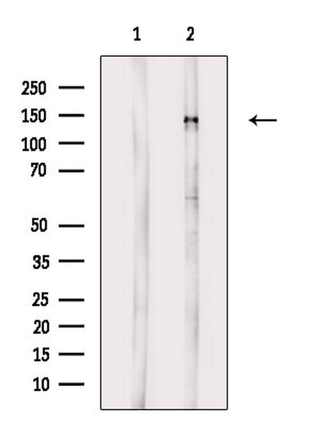 Phospho-PDGFRA (Tyr1018) Antibody in Western Blot (WB)