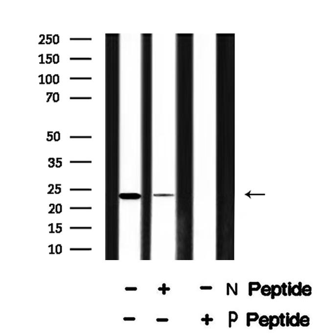 Phospho-NACA (Ser43) Antibody in Western Blot (WB)