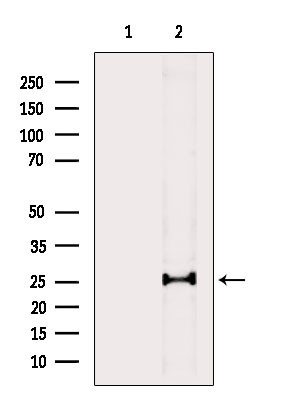Phospho-NACA (Thr159) Antibody in Western Blot (WB)