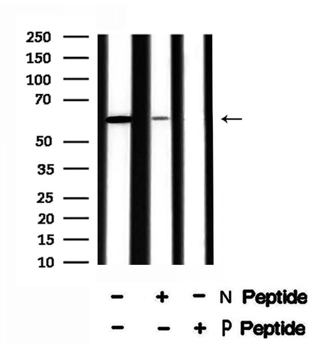 Phospho-SGOL1 (Ser14) Antibody in Western Blot (WB)