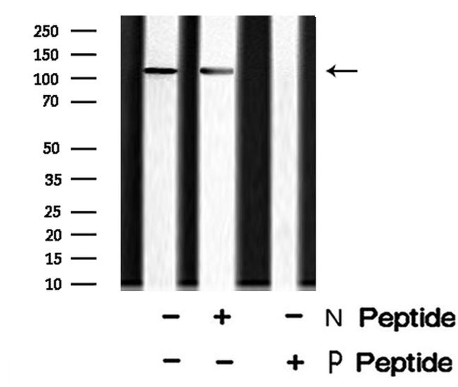 Phospho-EphA2 (Tyr930) Antibody in Western Blot (WB)