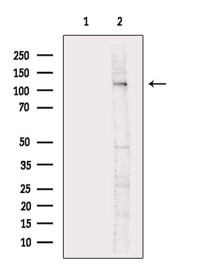 Phospho-EphB3 (Tyr608) Antibody in Western Blot (WB)