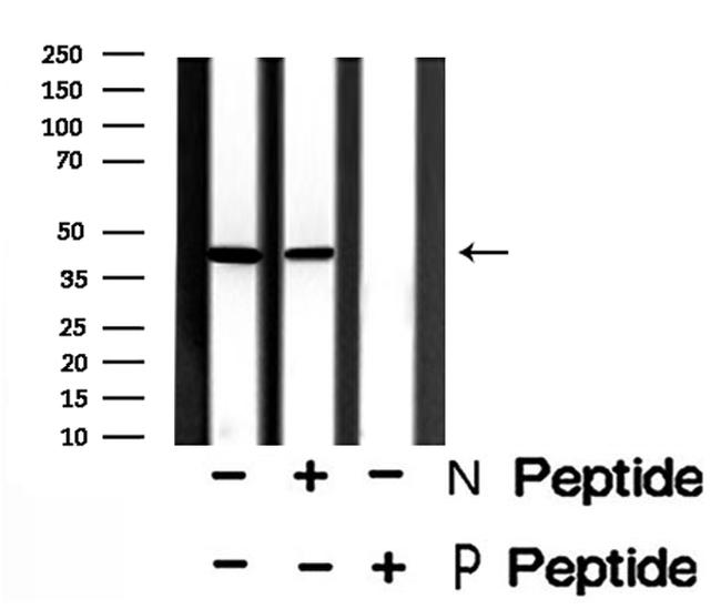 Phospho-C5AR1 (Ser327) Antibody in Western Blot (WB)
