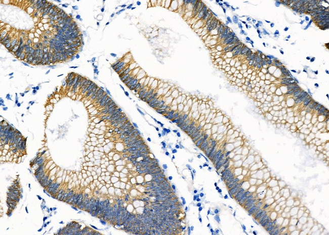 NKCC1 Antibody in Immunohistochemistry (Paraffin) (IHC (P))