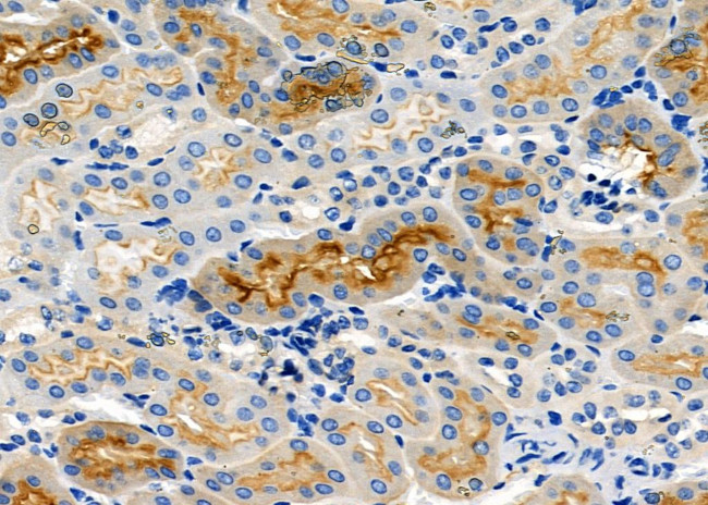 NKCC1 Antibody in Immunohistochemistry (Paraffin) (IHC (P))