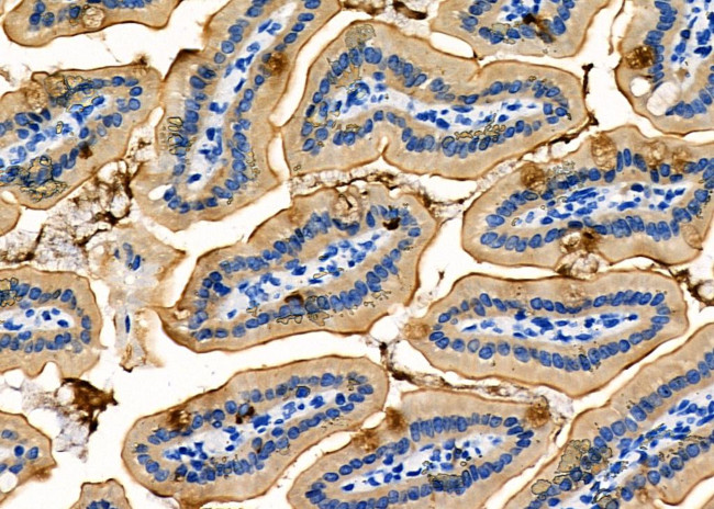 NKCC1 Antibody in Immunohistochemistry (Paraffin) (IHC (P))