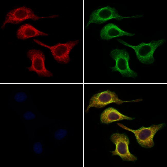 Arylsulfatase A Antibody in Immunocytochemistry (ICC/IF)