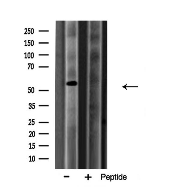 Arylsulfatase A Antibody in Western Blot (WB)