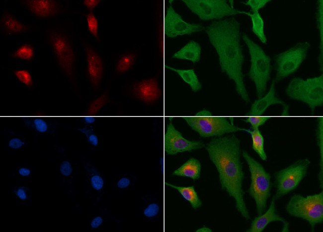 PYCARD Antibody in Immunocytochemistry (ICC/IF)