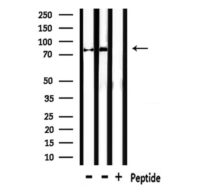 MFN1 Antibody in Western Blot (WB)