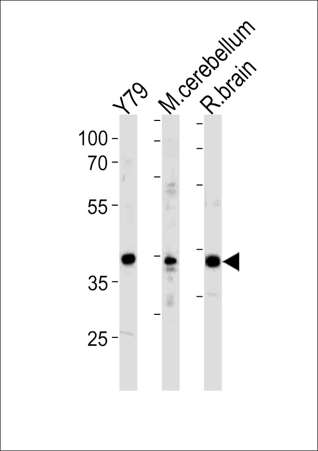 NeuroD1 Antibody in Western Blot (WB)