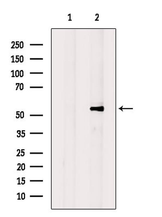 Annexin A11 Antibody in Western Blot (WB)