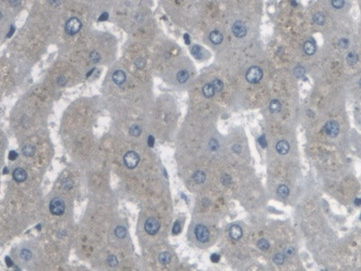 ARPC4 Antibody in Immunohistochemistry (Paraffin) (IHC (P))