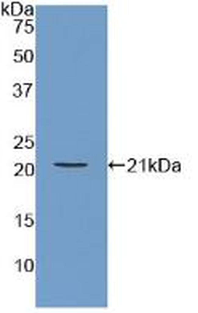 ARPC4 Antibody in Western Blot (WB)