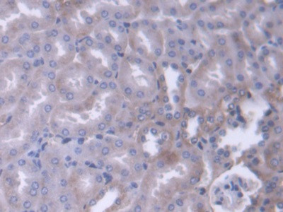 alpha Adducin Antibody in Immunohistochemistry (Paraffin) (IHC (P))