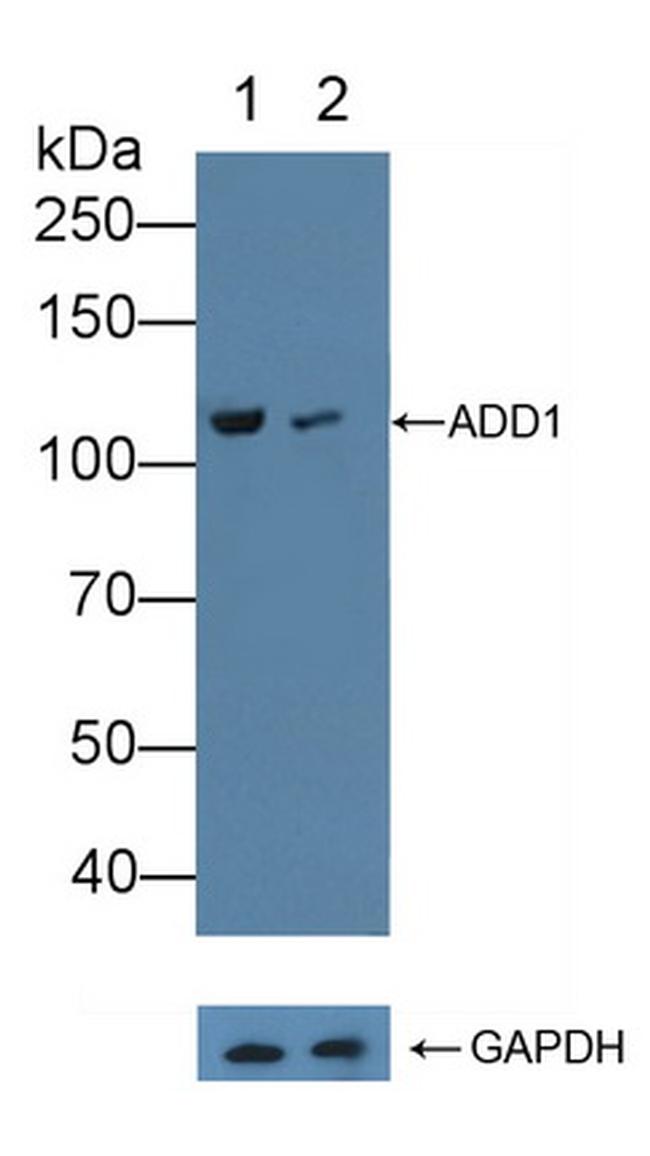 alpha Adducin Antibody in Western Blot (WB)