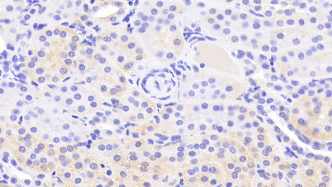 Annexin A9 Antibody in Immunohistochemistry (Paraffin) (IHC (P))