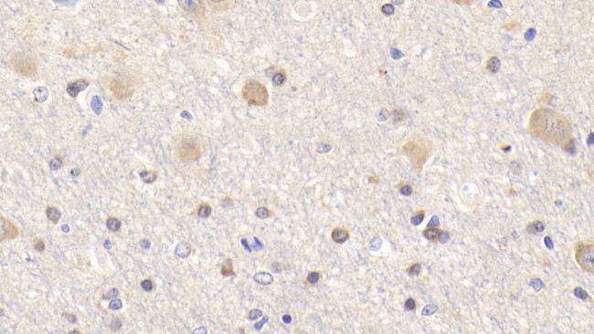 BID Antibody in Immunohistochemistry (Paraffin) (IHC (P))