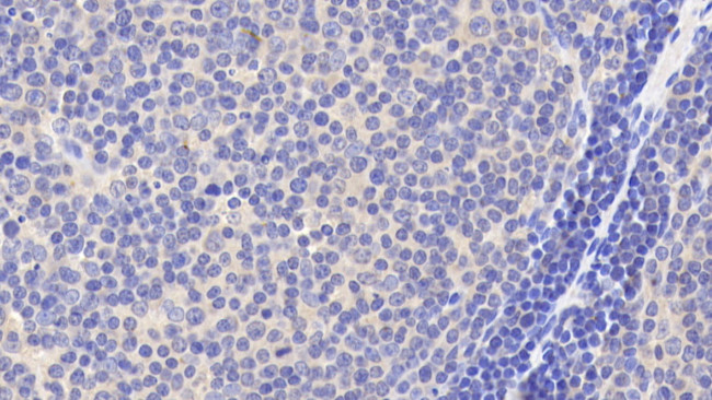 BID Antibody in Immunohistochemistry (Paraffin) (IHC (P))