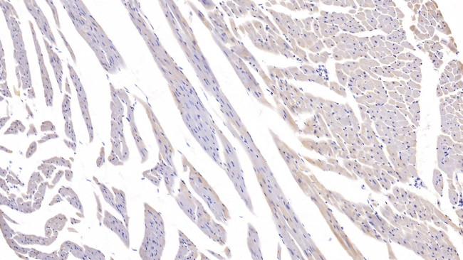 CaMKII gamma Antibody in Immunohistochemistry (Paraffin) (IHC (P))