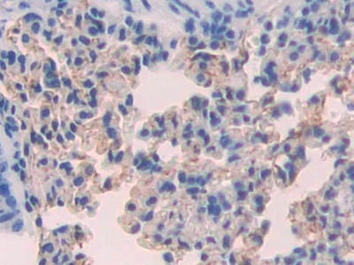 CD15 Antibody in Immunohistochemistry (Paraffin) (IHC (P))