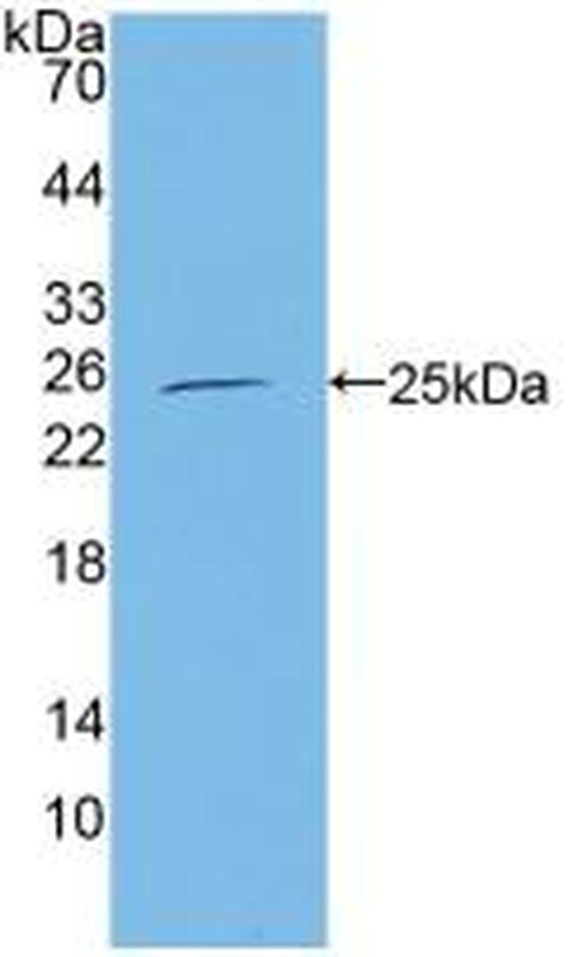 CBF beta Antibody in Western Blot (WB)