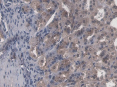 CBF beta Antibody in Immunohistochemistry (Paraffin) (IHC (P))